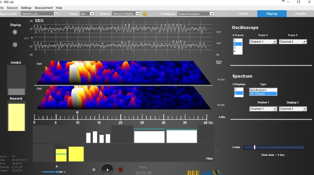 ILF neurofeedback BEELAB Neurofeedback SOFTWARE