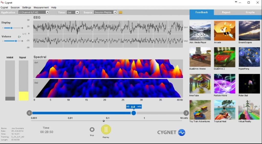 Powerful neurofeedback software for effective neurofeedback