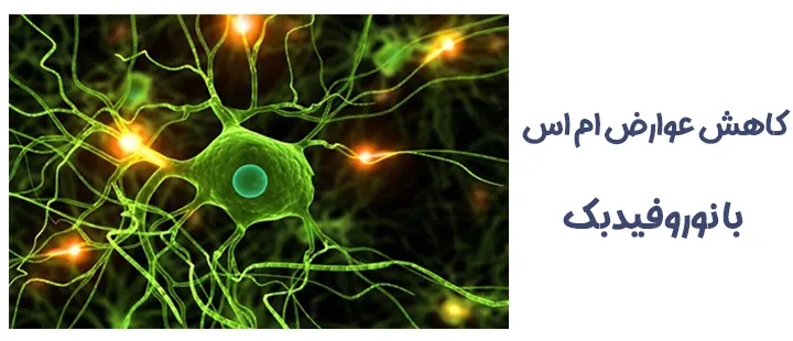 درمان ام اس با نوروفیدبک