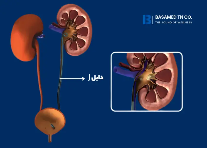 عمل ریرس